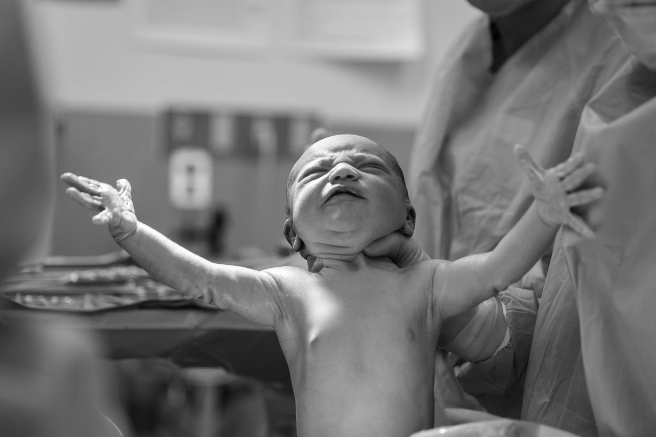 Tips and Questions to Ask for Scheduled C-Section Mamas